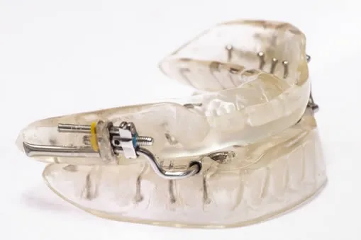 sleep apnea mouth guard